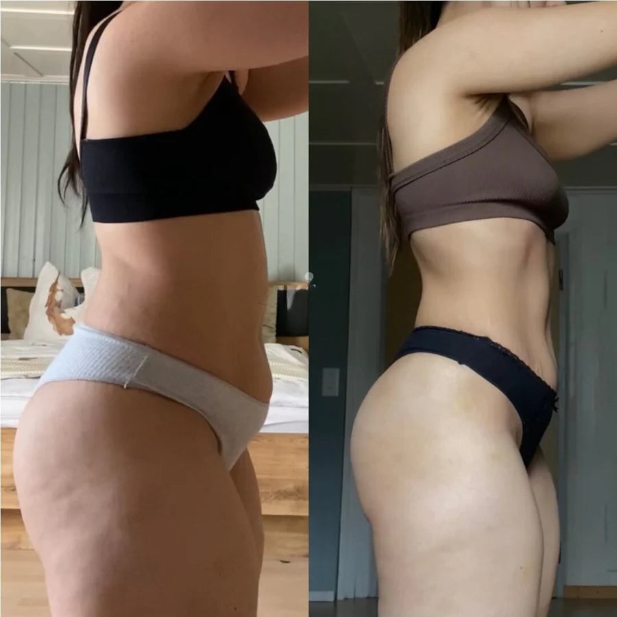 Patch Berberine Naturel Perte de Poids