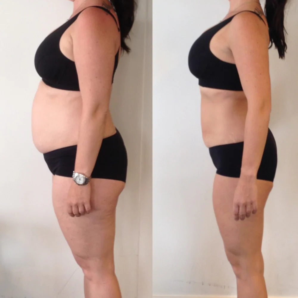 Patch Berberine Naturel Perte de Poids